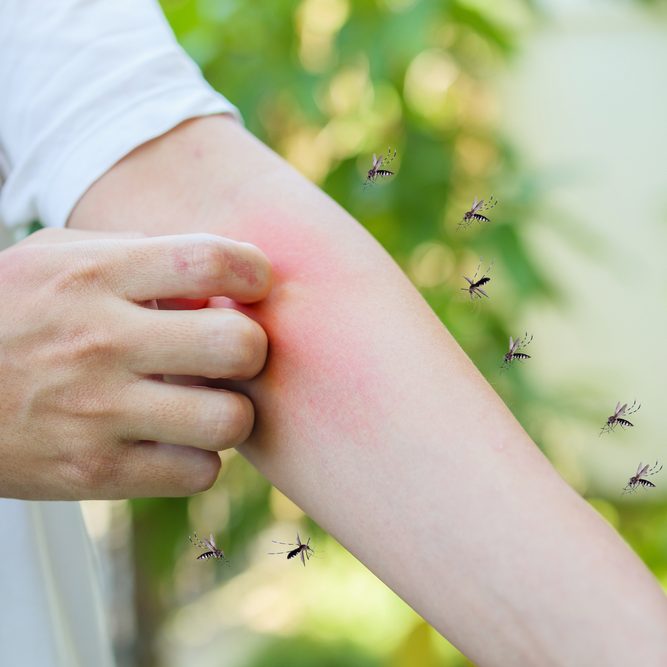 Man itching and scratching on arm from allergy skin rash Man itching and scratching on arm from allergy skin rash