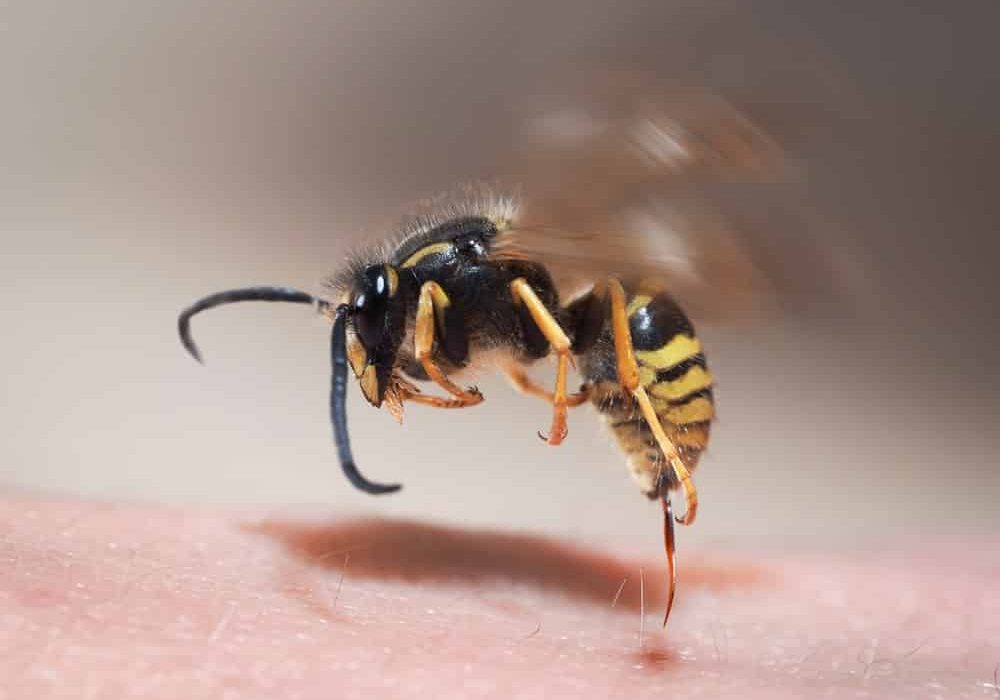 Wasp sting pulls out of human skin
