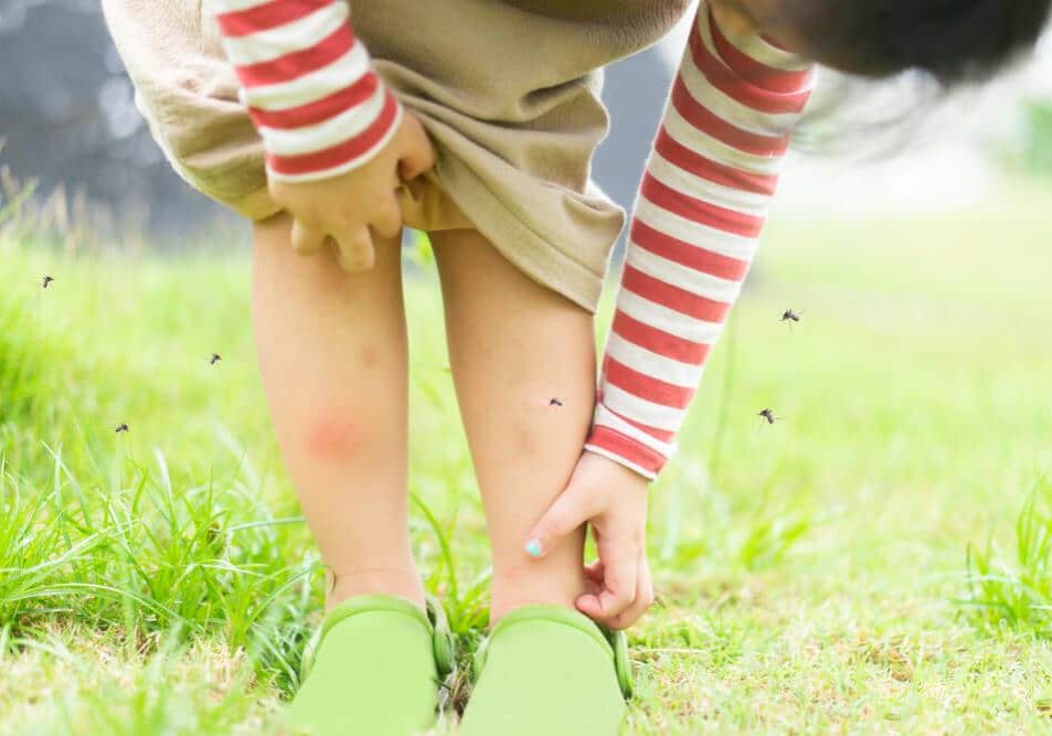 Little girl has allergies with mosquitoes bite and itching her leg