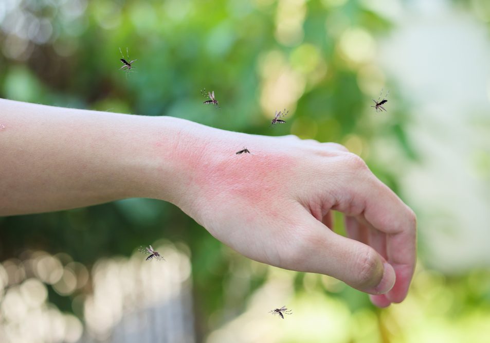 Mosquitoes bite on adult hand made skin rash and allergy with red spot Mosquitoes bite on adult hand made skin rash and allergy with red spot